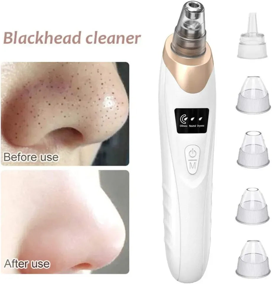 Electric Blackhead Remover | Vacuum Acne & Pore Cleaner